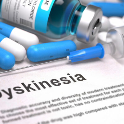 Main Treatment Options for Tremors and Dyskinesia