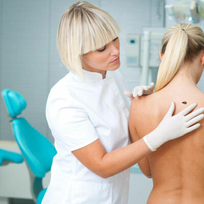 Melanoma: Causes, Symptoms, Treatment, and Prevention
