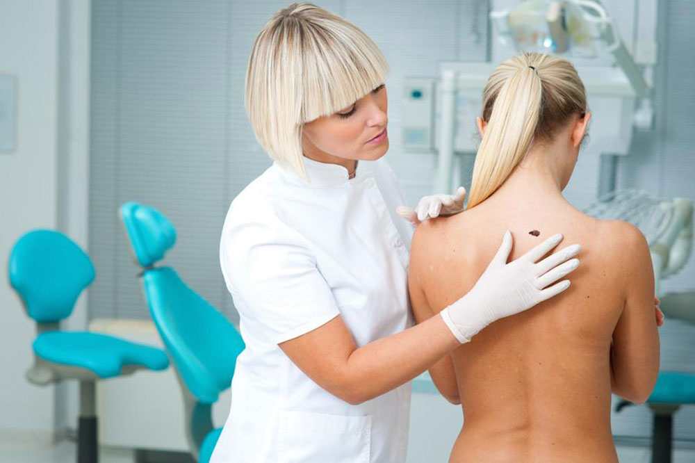 Melanoma: Causes, Symptoms, Treatment, and Prevention