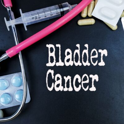 5 Early Warning Signs of Bladder Cancer